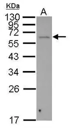 Anti-SGOL1 antibody used in Western Blot (WB). GTX117103