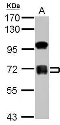 Anti-ZNF182 antibody used in Western Blot (WB). GTX117116