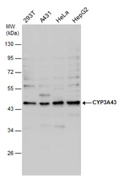 Anti-CYP3A43 antibody used in Western Blot (WB). GTX117120