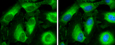 Anti-CYP3A43 antibody used in Immunocytochemistry/ Immunofluorescence (ICC/IF). GTX117120