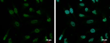 Anti-ZNF189 antibody used in Immunocytochemistry/ Immunofluorescence (ICC/IF). GTX117129