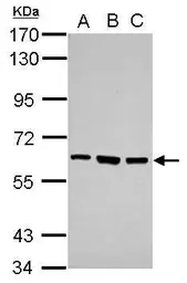 Anti-ZNF189 antibody used in Western Blot (WB). GTX117129