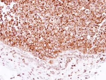 Anti-DECR1 antibody used in IHC (Paraffin sections) (IHC-P). GTX117130