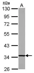 Anti-DECR1 antibody used in Western Blot (WB). GTX117130