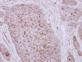 Anti-ZP2 antibody used in IHC (Paraffin sections) (IHC-P). GTX117141