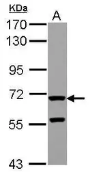 Anti-ZP2 antibody used in Western Blot (WB). GTX117141