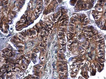 Anti-CLEC4A antibody used in IHC (Paraffin sections) (IHC-P). GTX117171