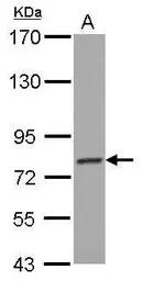 Anti-PCDHGB4 antibody [N1N2], N-term used in Western Blot (WB). GTX117173
