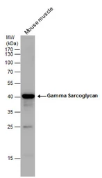 Anti-gamma Sarcoglycan antibody used in Western Blot (WB). GTX117176