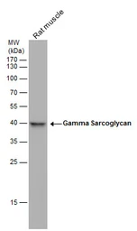 Anti-gamma Sarcoglycan antibody used in Western Blot (WB). GTX117176