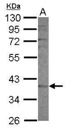 Anti-CYP2F1 antibody [N1C1] used in Western Blot (WB). GTX117184
