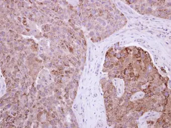 Anti-RAB11FIP1 antibody [N1N2], N-term used in IHC (Paraffin sections) (IHC-P). GTX117197
