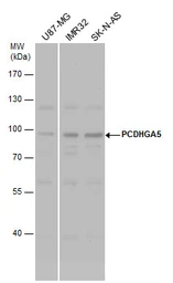 Anti-PCDHGA5 antibody used in Western Blot (WB). GTX117213