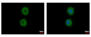 Anti-Cytokeratin 72 antibody used in Immunocytochemistry/ Immunofluorescence (ICC/IF). GTX117239