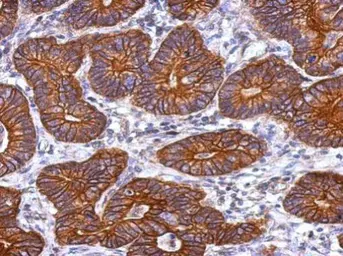 Anti-Cytokeratin 72 antibody used in IHC (Paraffin sections) (IHC-P). GTX117239