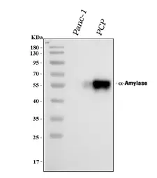 Anti-Amylase antibody used in Western Blot (WB). GTX11728