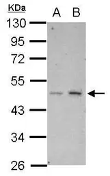 Anti-HTRA3 antibody used in Western Blot (WB). GTX117280