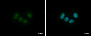 Anti-ZNF554 antibody used in Immunocytochemistry/ Immunofluorescence (ICC/IF). GTX117289