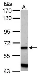 Anti-ZNF554 antibody used in Western Blot (WB). GTX117289
