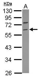 Anti-RNF36 antibody [N2C2], Internal used in Western Blot (WB). GTX117303