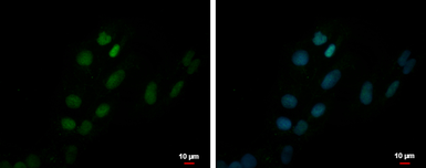 Anti-ZNF550 antibody used in Immunocytochemistry/ Immunofluorescence (ICC/IF). GTX117305