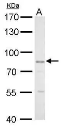 Anti-GLIS3 antibody used in Western Blot (WB). GTX117310