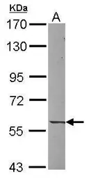 Anti-UNC5CL antibody [C1C3] used in Western Blot (WB). GTX117321
