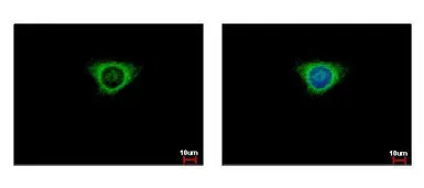 Anti-Glutathione S-transferase kappa 1 antibody used in Immunocytochemistry/ Immunofluorescence (ICC/IF). GTX117326