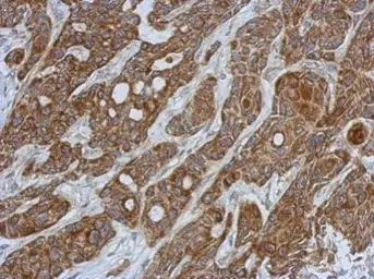 Anti-Glutathione S-transferase kappa 1 antibody used in IHC (Paraffin sections) (IHC-P). GTX117326