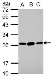Anti-Glutathione S-transferase kappa 1 antibody used in Western Blot (WB). GTX117326