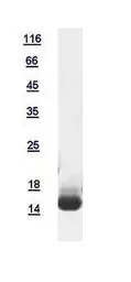 Human RBP1 protein, His tag. GTX117328-pro