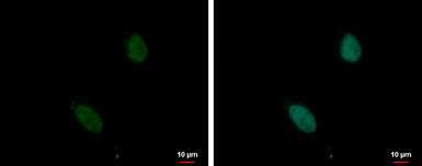 Anti-ZNF124 antibody used in Immunocytochemistry/ Immunofluorescence (ICC/IF). GTX117346