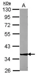 Anti-ZNF396 antibody used in Western Blot (WB). GTX117367