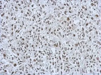 Anti-RALY antibody used in IHC (Paraffin sections) (IHC-P). GTX117389
