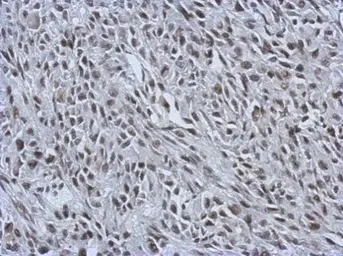 Anti-RALY antibody used in IHC (Paraffin sections) (IHC-P). GTX117389