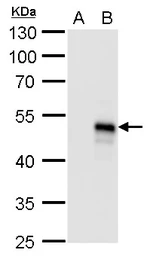 Anti-BMP8b antibody used in Western Blot (WB). GTX117409