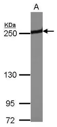 Anti-Periplakin antibody [N1N2], N-term used in Western Blot (WB). GTX117411