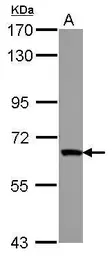 Anti-ZNF543 antibody [N1N3-2] used in Western Blot (WB). GTX117416