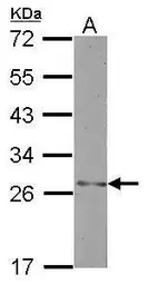 Anti-Testis-specific H1 histone antibody used in Western Blot (WB). GTX117438