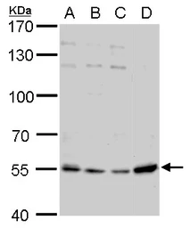Anti-Visfatin antibody [N1N3] used in Western Blot (WB). GTX117444