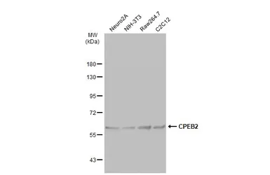 Anti-CPEB2 antibody used in Western Blot (WB). GTX117457