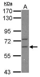 Anti-CPEB2 antibody used in Western Blot (WB). GTX117457