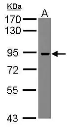 Anti-ADAM23 antibody [N2C1], Internal used in Western Blot (WB). GTX117462
