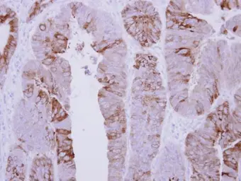 Anti-COLQ antibody used in IHC (Paraffin sections) (IHC-P). GTX117469