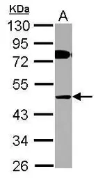 Anti-COLQ antibody used in Western Blot (WB). GTX117469