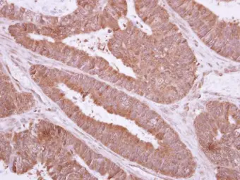 Anti-TXNDC6 antibody used in IHC (Paraffin sections) (IHC-P). GTX117495