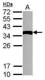 Anti-TXNDC6 antibody used in Western Blot (WB). GTX117495