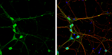 Anti-CLIP170 antibody [N1], N-term used in Immunocytochemistry/ Immunofluorescence (ICC/IF). GTX117504