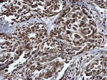 Anti-p53 (mono-methyl Lys372) antibody used in IHC (Paraffin sections) (IHC-P). GTX117515