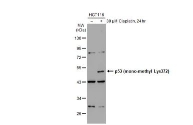 Anti-p53 (mono-methyl Lys372) antibody used in Western Blot (WB). GTX117515